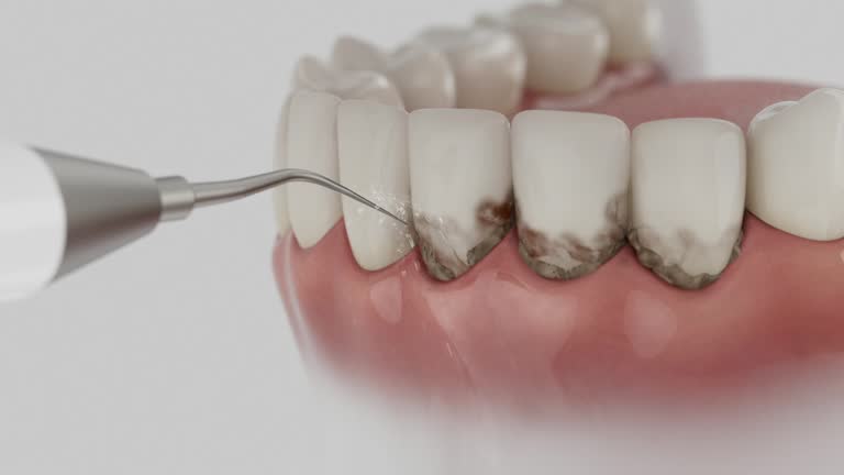 Reliable Dental contractor in Ames, TX by Smile Center Dentistry